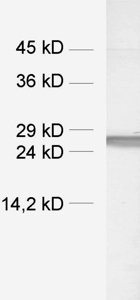 GFP, Polyclonal rabbit antiserum