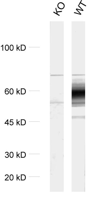 VGLUT1 Polyclonal rabbit antiserum - image 2