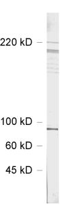 Shank3 Polyclonal rabbit antiserum - image 1