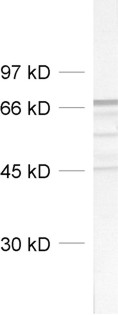 Neurofilament L Polyclonal rabbit antiserum - image 1