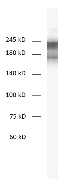 Neurofilament H Recombinant rabbit - image 1