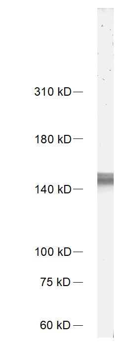 Neurofilament M Recombinant rabbit - image 1