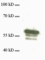 Vimentin Polyclonal rabbit antiserum - image 1