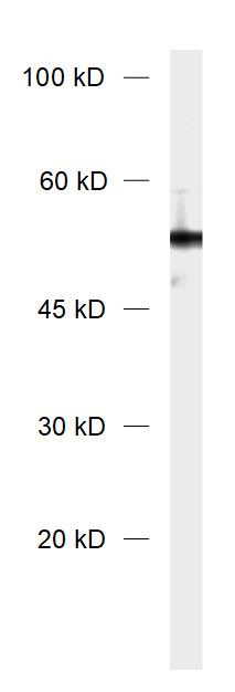 Vimentin, Polyclonal Guinea pig antiserum