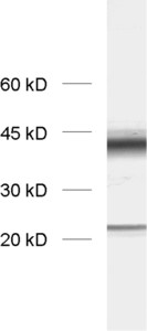 ZnT3, Polyclonal rabbit antiserum