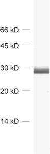 Calbindin D28k Polyclonal rabbit antiserum - image 1