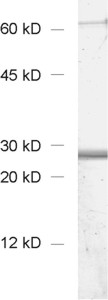 Calbindin D28k Polyclonal Guinea pig antiserum - image 1