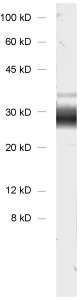 Calbindin D28k Polyclonal chicken IgY fraction - image 1
