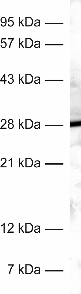 Calretinin Recombinant rabbit - image 1