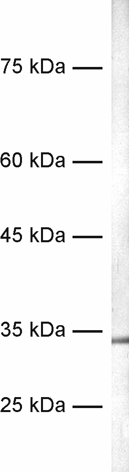 Calretinin Recombinant Guinea pig - image 1