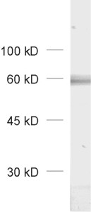 GABA-A receptor alpha3 Polyclonal rabbit antiserum - image 1