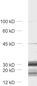 SV31, Polyclonal rabbit antiserum