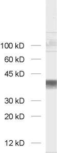 GAPDH, Polyclonal rabbit antiserum