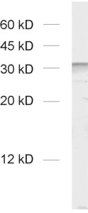 VAP-A Polyclonal rabbit antiserum - image 1