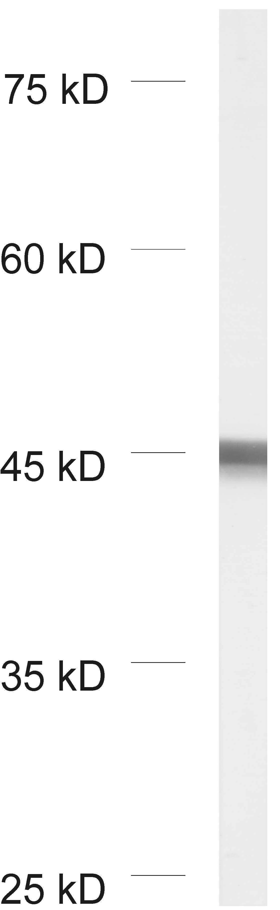 beta-Actin, Recombinant chicken