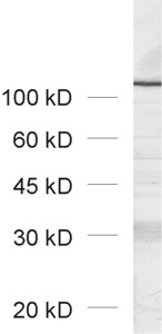 Glycogen phosphorylase Polyclonal rabbit antiserum - image 1