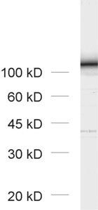 Glycogen phosphorylase Polyclonal rabbit purified antibody - image 1