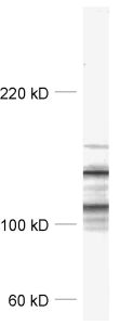 EPB41L2 / 4.1G Polyclonal rabbit antiserum - image 1