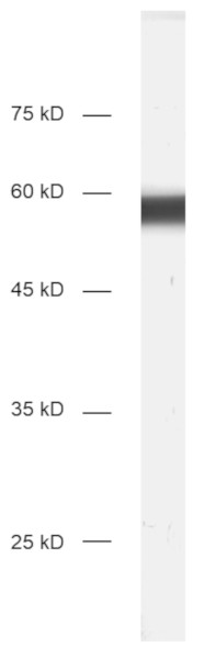 beta3-Tubulin Recombinant rabbit - image 1