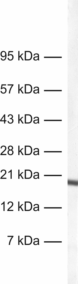 MLC-2V Recombinant rabbit - image 1