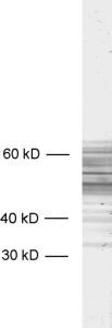 Tau, Polyclonal rabbit antiserum