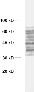 Tau, Polyclonal rabbit antiserum