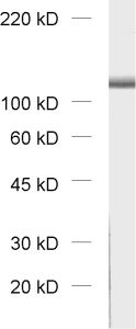 VPS18, Polyclonal rabbit purified antibody
