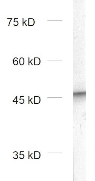 Doublecortin, Polyclonal Guinea pig antiserum