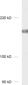 dilution: 1&nbsp;:&nbsp;1000<br><div> sample: Jurkat cell lysate</div><div>detection: AP-staining<br></div>