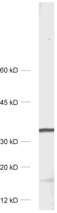 DARPP32, Polyclonal rabbit antiserum