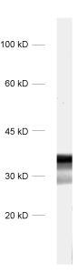 DARPP32, Polyclonal Guinea pig antiserum