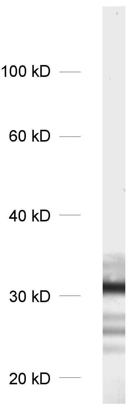 RFP, Polyclonal Guinea pig antiserum