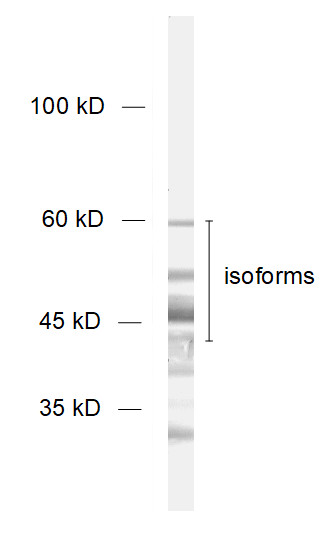 BCAS1 Polyclonal Guinea pig antiserum - image 1