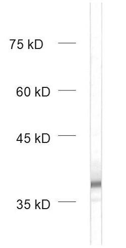 ApoE, Polyclonal Guinea pig antiserum