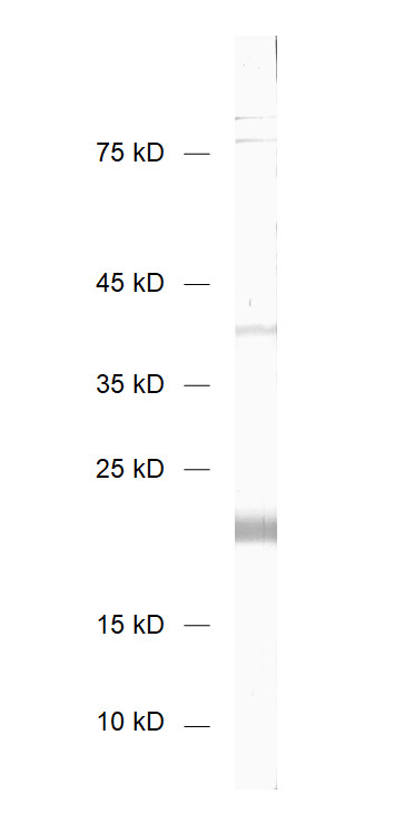 CaBP5, Polyclonal rabbit antiserum