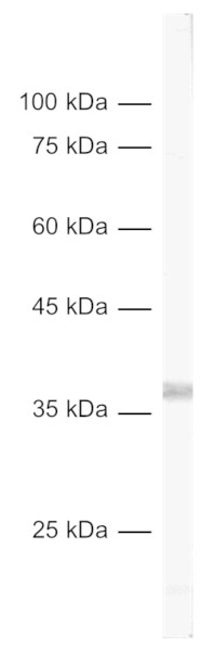 GC2, Polyclonal Guinea pig antiserum