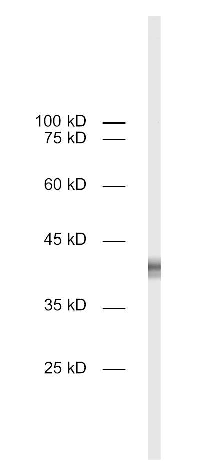 CD8a, Polyclonal rabbit purified antibody