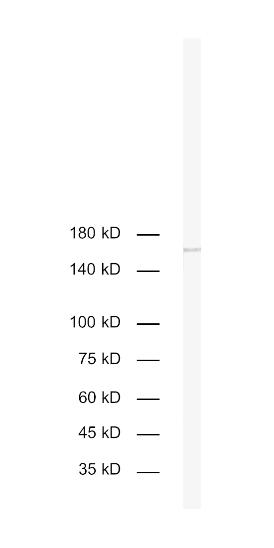 Dilution: 1&nbsp;:&nbsp;1000<br> Sample: mouse spleen<br> Observed MW: ~160 kD<br> Detection: AP-staining