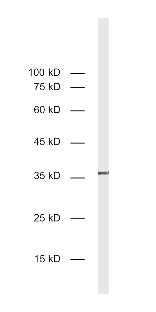 Galectin-3 Recombinant rabbit - image 1