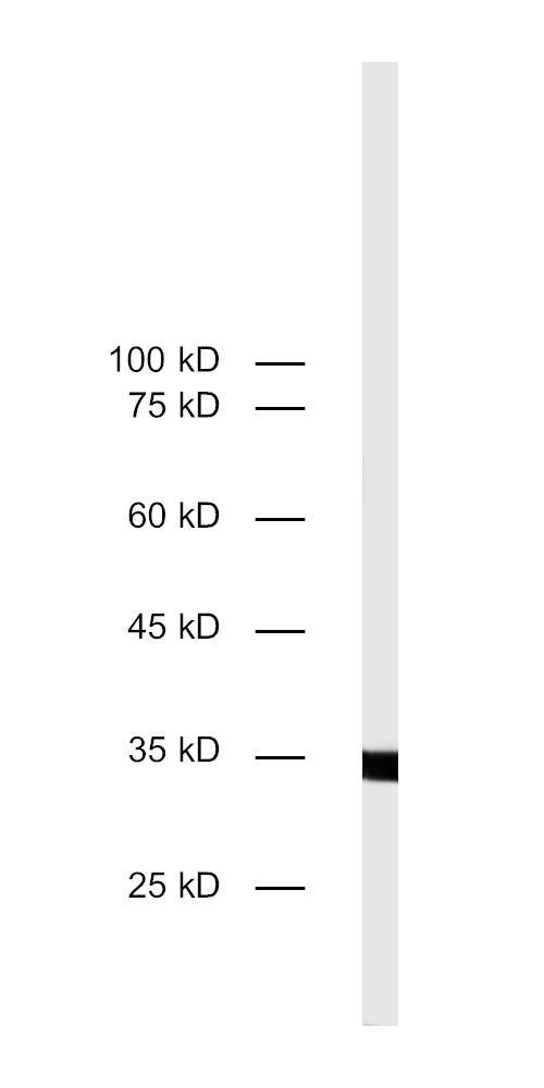 Galectin-3 Recombinant rabbit - image 2