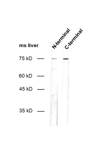 Dilution: 1&nbsp;:&nbsp;500<br>Sample: Total lysate of mouse liver. CLEC4F N-terminal antibody (cat.&nbsp;no. HS-501&nbsp;103). CLEC4F C-terminal antibody (cat.&nbsp;no. HS-501&nbsp;003).<br>Observed MW: ~75 kD<br>Detection: AP-staining​