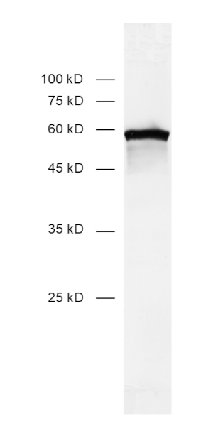 Desmin Monoclonal rabbit - image 2